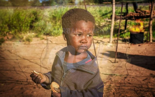 suy dinh dưỡng ở trẻ