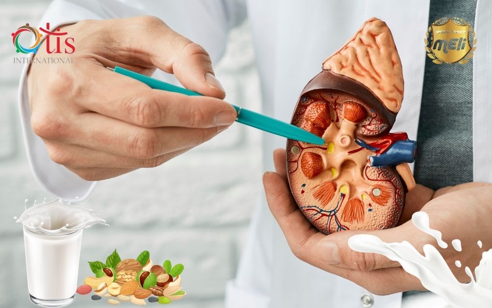 Sỏi thận có thể gây ra cảm giác buồn tiểu nhiều lần. Khi sỏi di chuyển trong đường tiểu