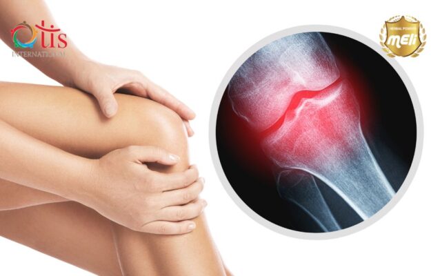 4 Nguyên Nhân Khiến Khớp Xương Yếu