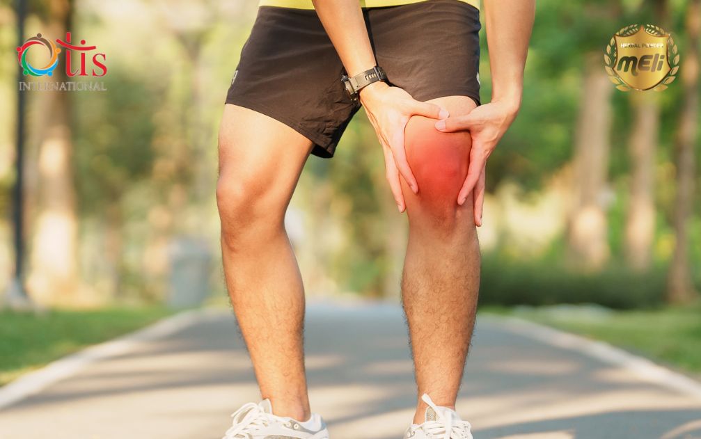 Giảm Khả Năng Vận Động, Biến Dạng Khớp